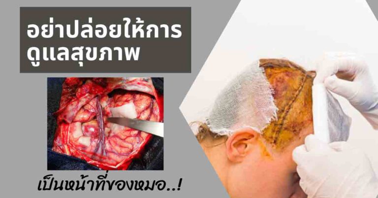 olisaq10 โอลิซ่าคิวเท็น