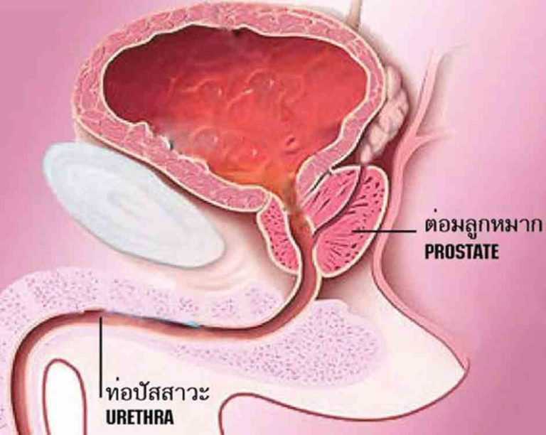 Tomazing Plus โทเมซิงพลัส